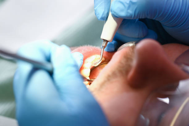 Best Weekend Emergency Dentist in Manassas Park, VA
